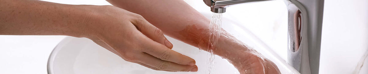 Brandwonden verzorging BENU